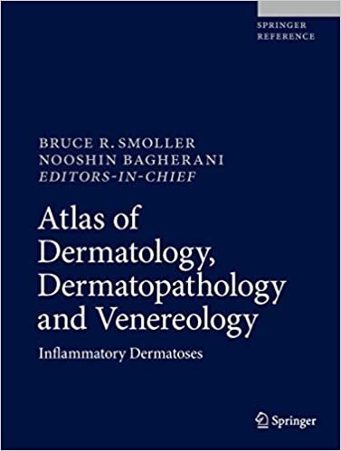 ダウンロード  Atlas of Dermatology, Dermatopathology and Venereology: Inflammatory Dermatoses 本