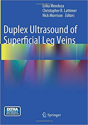 indir Duplex Ultrasound of Superficial Leg Veins