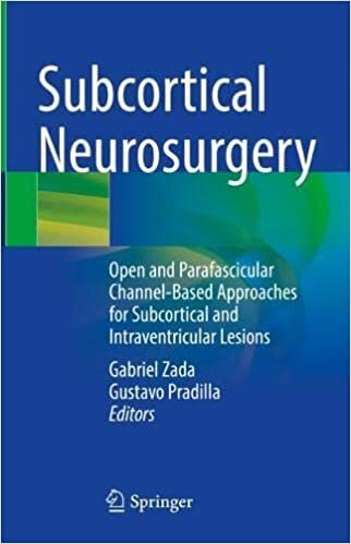 تحميل Subcortical Neurosurgery: Open and Parafascicular Channel-Based Approaches for Subcortical and Intraventricular Lesions