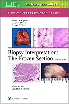 اقرأ Biopsy Interpretation: The Frozen Section الكتاب الاليكتروني 