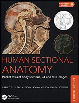 Adrian Kendal Dixon Human Sectional Anatomy, ‎4‎th Edition تكوين تحميل مجانا Adrian Kendal Dixon تكوين