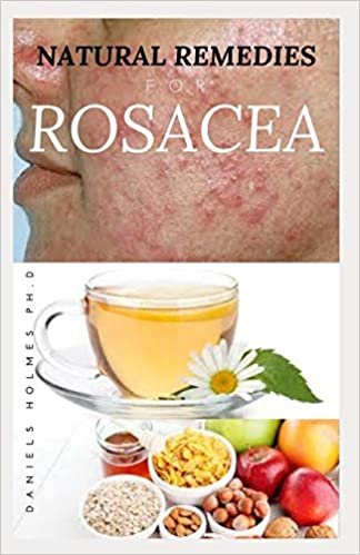 NATURAL REMEDIES FOR ROSACEA: Treating Rosacea with Natural Home Remedies Includes Nose Redness,Acne,Eczema and Lots More indir