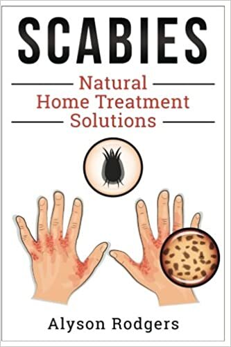 indir Scabies Natural Home Treatment Solution