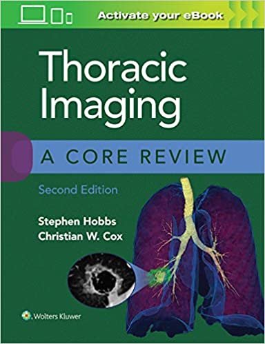 indir Thoracic Imaging: A Core Review