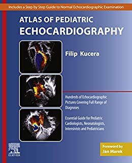 ダウンロード  Atlas of Pediatric Echocardiography, E-Book (English Edition) 本