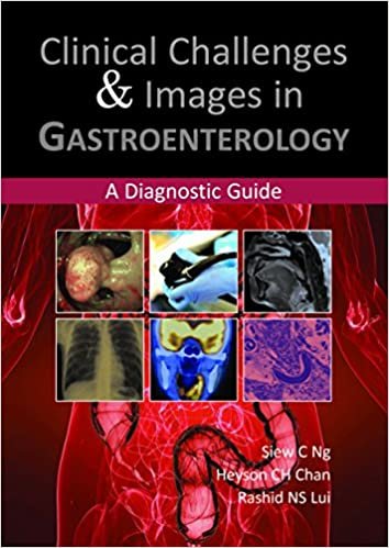 Clinical Challenges and Images in Gastroenterology indir