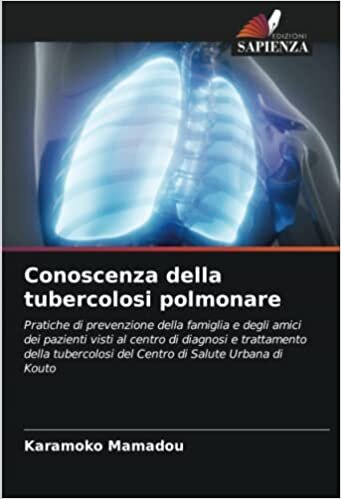 Conoscenza della tubercolosi polmonare (Italian Edition)