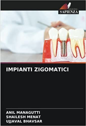 تحميل IMPIANTI ZIGOMATICI (Italian Edition)