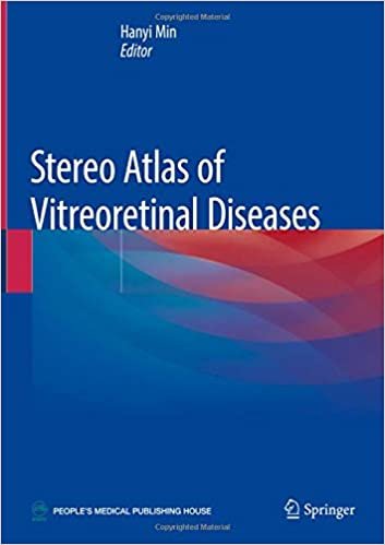 تحميل Stereo Atlas of Vitreoretinal Diseases