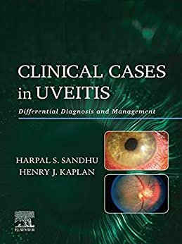 ダウンロード  Clinical Cases in Uveitis E-Book: Differential Diagnosis and Management (English Edition) 本
