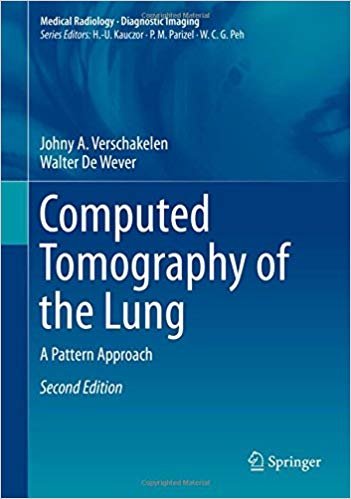 indir Computed Tomography of the Lung : A Pattern Approach