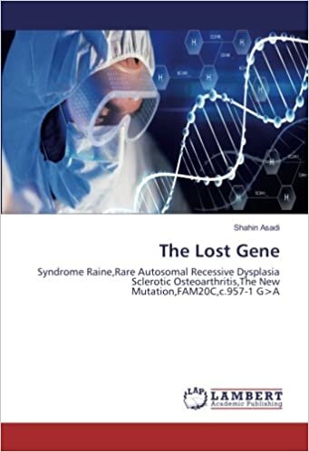 The Lost Gene: Syndrome Raine,Rare Autosomal Recessive Dysplasia Scl Osteoarthritis,The New Mutation,FAM20C,c.957-1 G>A indir
