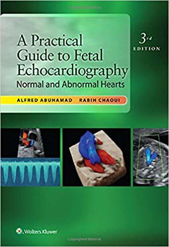 indir A Practical Guide to Fetal Echocardiography