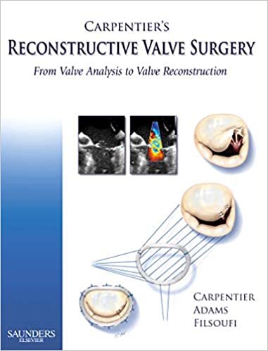 Carpentier's Reconstructive Valve Surgery, 1e