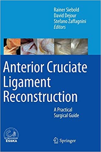 indir Anterior Cruciate Ligament Reconstruction : A Practical Surgical Guide