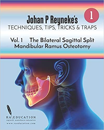 Johan P Reyneke's Techniques, Tips, Tricks and Traps: Volume 1: The Bilateral Sagittal Split Mandibular Ramus Osteotomy indir