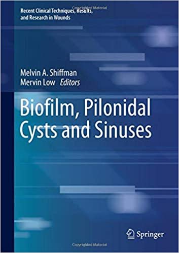 تحميل Biofilm, Pilonidal Cysts and Sinuses