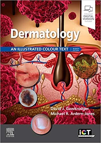 ダウンロード  Dermatology: An Illustrated Colour Text 本