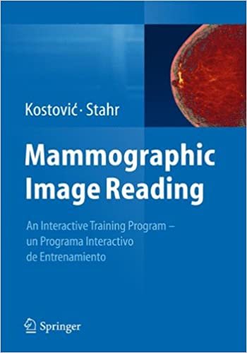 Mammographic Image Reading: An interactive training program - un programa interactivo de entrenamiento