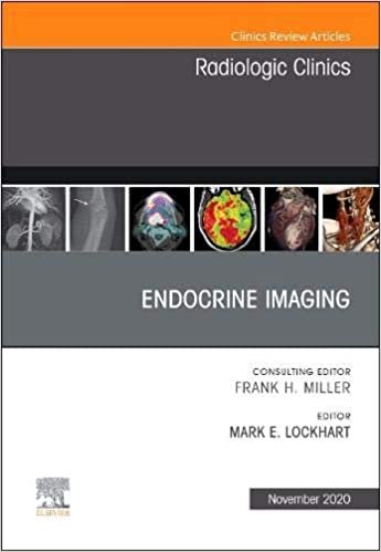 ダウンロード  Endocrine Imaging , An Issue of Radiologic Clinics of North America (Volume 58-6) (The Clinics: Radiology, Volume 58-6) 本