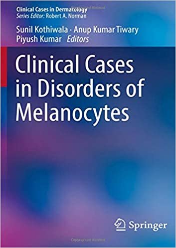 اقرأ Clinical Cases in Disorders of Melanocytes الكتاب الاليكتروني 