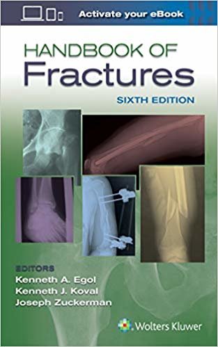 تحميل Handbook of Fractures