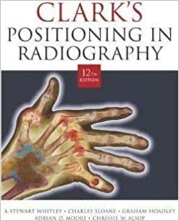  بدون تسجيل ليقرأ Clark's Positioning in Radiography