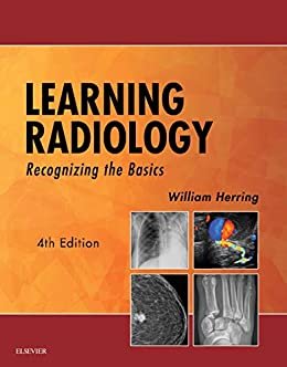 ダウンロード  Learning Radiology E-Book: Recognizing the Basics (English Edition) 本