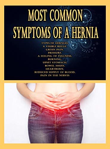 Most Common Symptoms of a Hernia: Types of Hernias, A Visible Bulge, Groin Pain, Pressure, A Feeling of Fullness, Burning, Upset Stomach, Bowel Issues, ... Reduced Supply of Blood (English Edition)