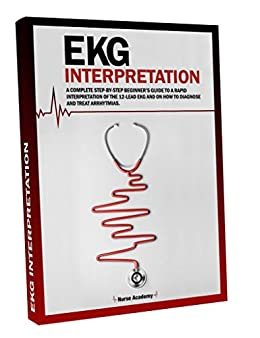 ダウンロード  EKG Interpretation: A complete step-by-step beginner’s guide to a rapid interpretation of the 12-lead EKG and on how to diagnose and treat arrhytmias. (English Edition) 本