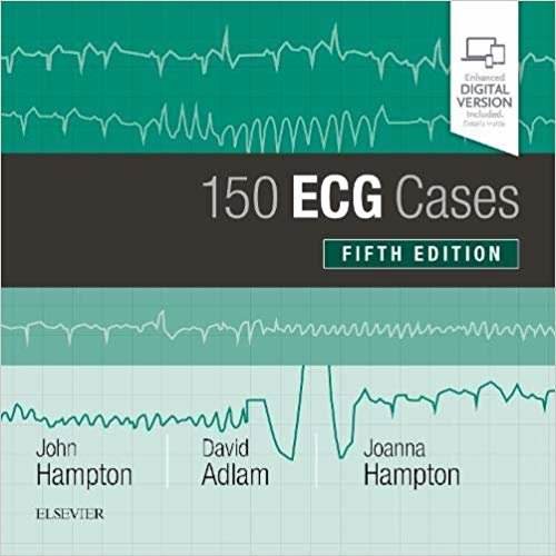 تحميل 150 ECG Cases