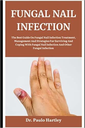 تحميل FUNGAL NAIL INFECTION: The Best Guide On Fungal Nail Infection Treatment, Management And Strategies For Surviving And Coping With Fungal Nail Infection And Other Fungal Infection
