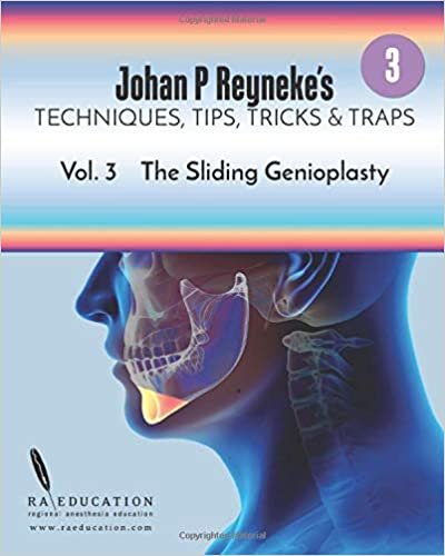 Johan P. Reyneke's Techniques, Tips, Tricks and Traps Vol 3: The Sliding Genioplasty indir