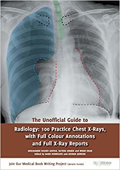 تحميل The غير رسمي دليل إلى radiology: 100 ممارسة الصدر أشعة X مع لون كامل annotations و بالكامل x Ray وتشير التقارير (غير رسمي من أدلة إلى الدواء)
