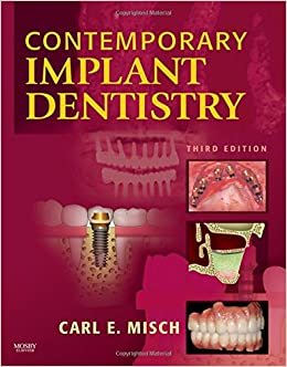اقرأ معاصر implant dentistry ، 3E الكتاب الاليكتروني 