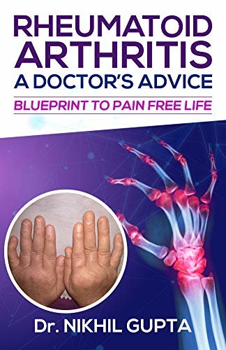 ダウンロード  RHEUMATOID ARTHRITIS – A DOCTOR’s ADVICE : BLUEPRINT TO PAIN FREE LIFE (English Edition) 本
