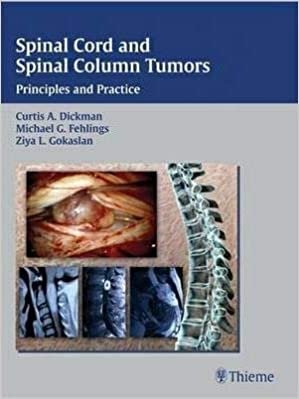 Curtis Dickman Spinal Cord and Spinal Column Tumors: Principles and Practice تكوين تحميل مجانا Curtis Dickman تكوين
