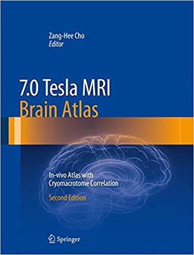 indir 7.0 Tesla MRI Brain Atlas : In-vivo Atlas with Cryomacrotome Correlation
