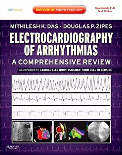 indir Electrocardiography of Arrhythmias: A Comprehensive Review, 1st Edition