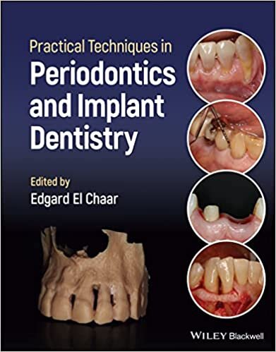 تحميل Practical Techniques in Periodontics and Implant Dentistry