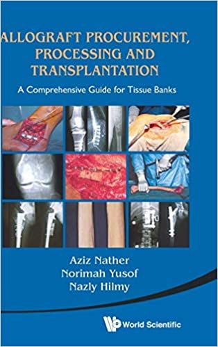 ダウンロード  Allograft Procurement, Processing and Transplantation: A Comprehensive Guide for Tissue Bank 本