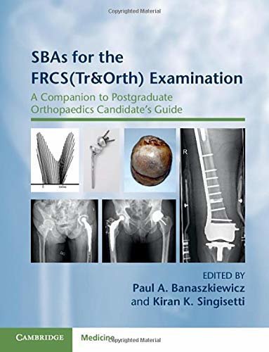 ダウンロード  SBAs for the FRCS(Tr&Orth) Examination: A Companion to Postgraduate Orthopaedics Candidate's Guide (English Edition) 本