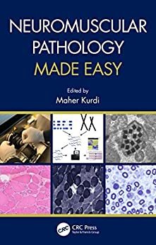 ダウンロード  Neuromuscular Pathology Made Easy (English Edition) 本