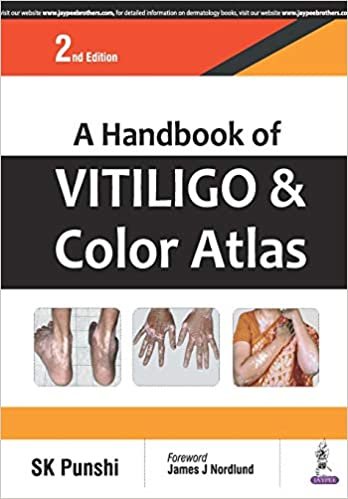 Handbook of Vitiligo & Color Atlas, ‎2‎nd Edition