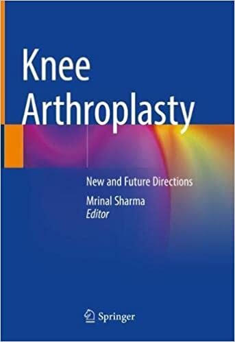 تحميل Knee Arthroplasty: New and Future Directions