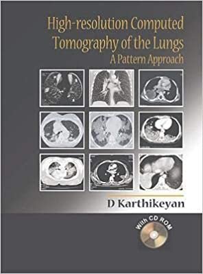 D Karthikeyan High-Resolution Computed Tomography of the Lungs: A Pattern Approach تكوين تحميل مجانا D Karthikeyan تكوين