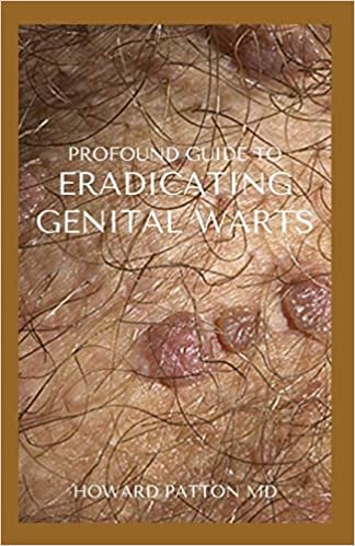 PROFOUND GUIDE TO ERADICATING WARTS: The Effective Guide To Help You Destroy Your Existing Warts indir