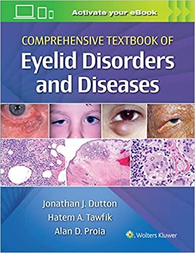 تحميل Comprehensive Textbook of Eyelid Disorders