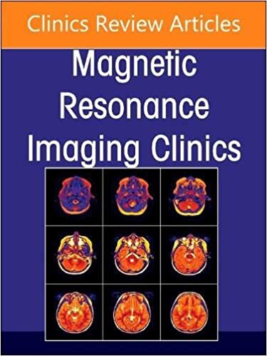 MR Imaging of the Adnexa, An Issue of Magnetic Resonance Imaging Clinics of North America (Volume 31-1) (The Clinics: Radiology, Volume 31-1)