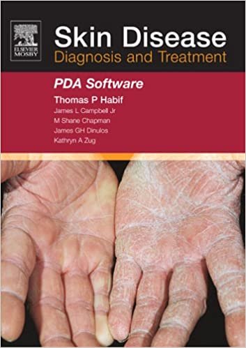 Skin Disease - CD-ROM PDA Software: Diagnosis and Treatment ダウンロード